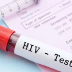 نهج جديد للقاحات المضادة لفيروس نقص المناعة يظهر نتائج مبكرة واعدة